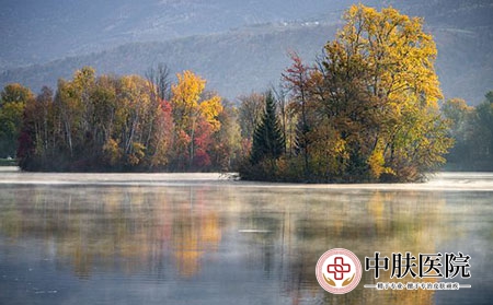 济南银屑病医院 (127)