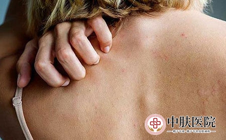 症状 (2)