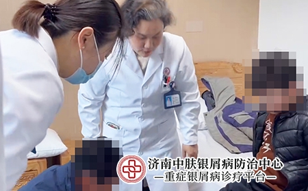 济南哪个医院看银屑病-济南中肤银屑病医院 济南哪个医院看银屑病-济南中肤银屑病医院