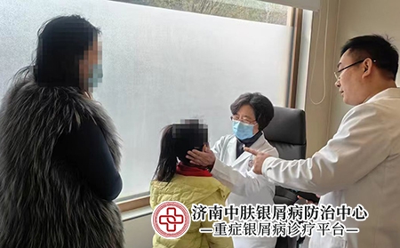 济南哪个银屑病医院专业-济南中肤银屑病医院 济南哪个银屑病医院专业-济南中肤银屑病医院