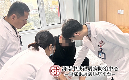 济南银屑病医院怎么样-济南中肤银屑病医院 济南银屑病医院怎么样-济南中肤银屑病医院