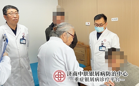 山东济南最好的银屑病医院-济南中肤银屑病医院