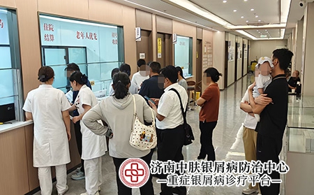 济南历城银屑病专科门诊-济南中肤医院