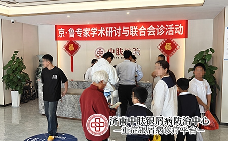 山东银屑病医院排名-济南中肤医院