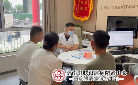 济南张代国治牛皮癣-济南中肤专科门诊