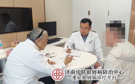 济南银屑病医院电话-济南中肤银屑病医院