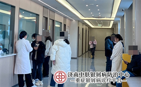 济南治疗银屑病老中医-济南中肤银屑病医院