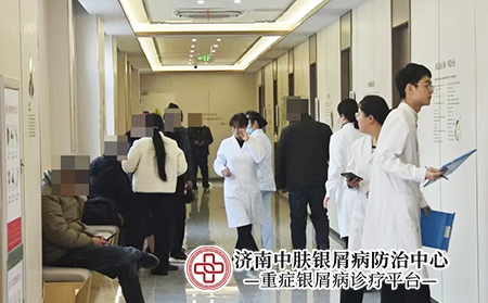 济南哪里治疗银屑病-济南中肤银屑病医院