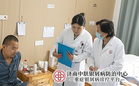 济南寻常型银屑病医生-济南中肤医院